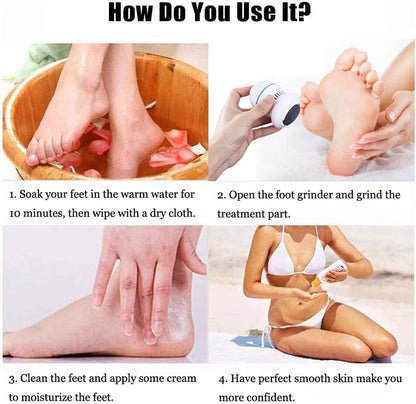 MeySmooth™ Electric Foot Grinder – The Ultimate Foot Care Tool You Didn't Know You Needed!